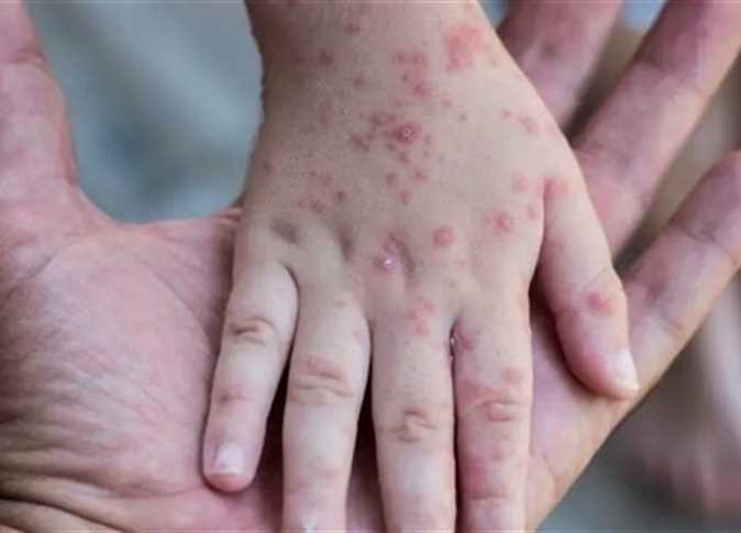 7D87AA3E-BEAC-4EE6-9465-032CA6203FC7